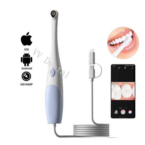 Telecamera intraorale dentale