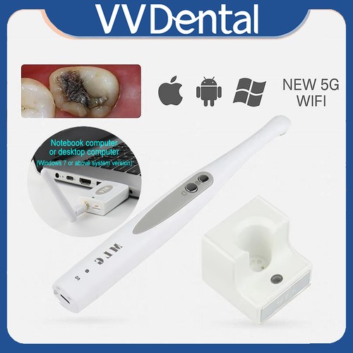 Telecamera intraorale dentale