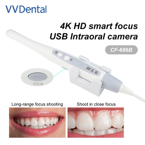 Telecamera intraorale dentale