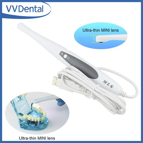 Telecamera intraorale dentale