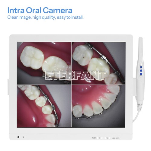 Fotocamera intraorale dentale