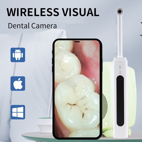 Telecamera orale wireless