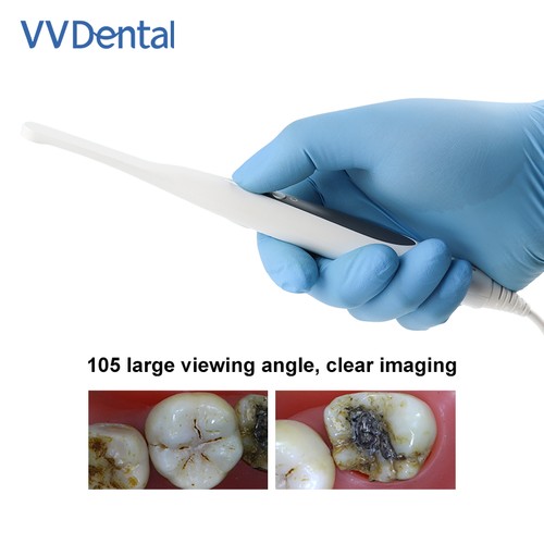 Telecamera intraorale dentale