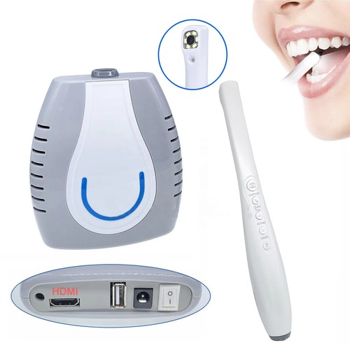 Telecamera intraorale dentale