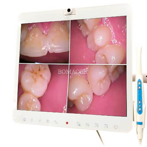 Set monitor dentale - 1, sistema
