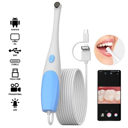 Telecamera intraorale dentale