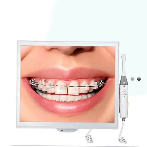 Telecamera intraorale dentale