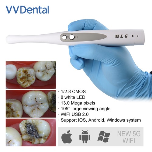 Telecamera intraorale dentale