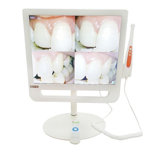 Telecamera intraorale dentale