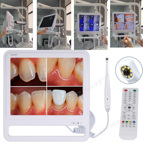 Inch dental intra - 17,