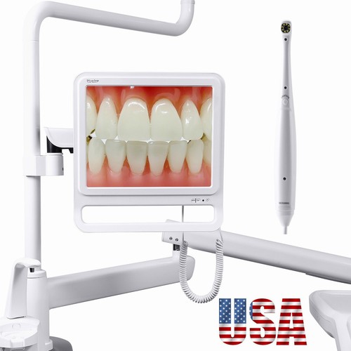 Telecamera intraorale dentale