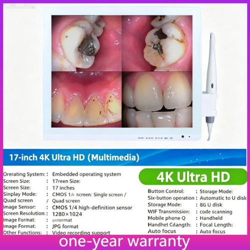 Telecamera intraorale dentale