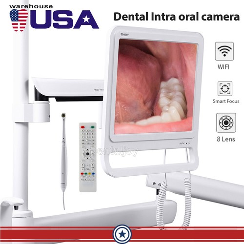 Telecamera intraorale dentale