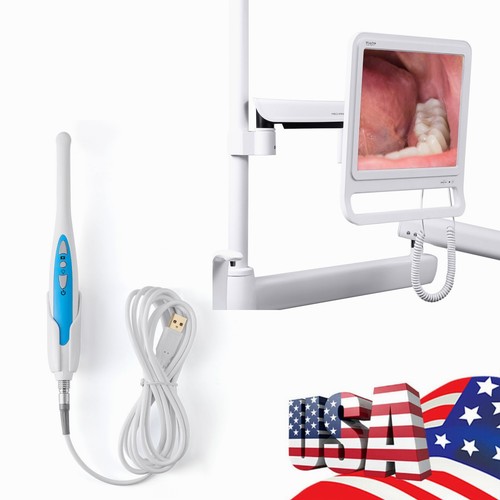Telecamera intraorale dentale