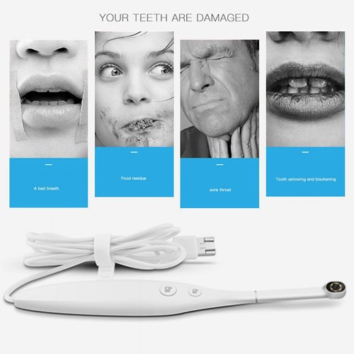 Telecamera intraorale dentale