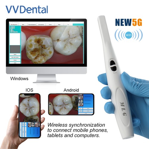 Visore orale wireless dentale